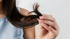Dietister: 4 matvanor som oåterkalleligt förstör håret